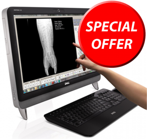 Digital-X-Ray-machine Special Offer